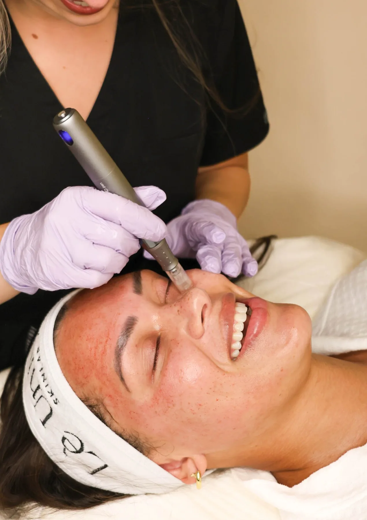 Microneedling vs RF microneedling: which is right for you? — Lè Unique Skinlab Southlake